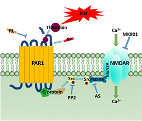 脑出血的前期治疗方法,脑出血的治疗指南2015版