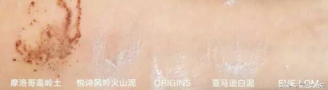 夏天油性皮肤用什么面膜,夏天油腻腻的怎么护肤