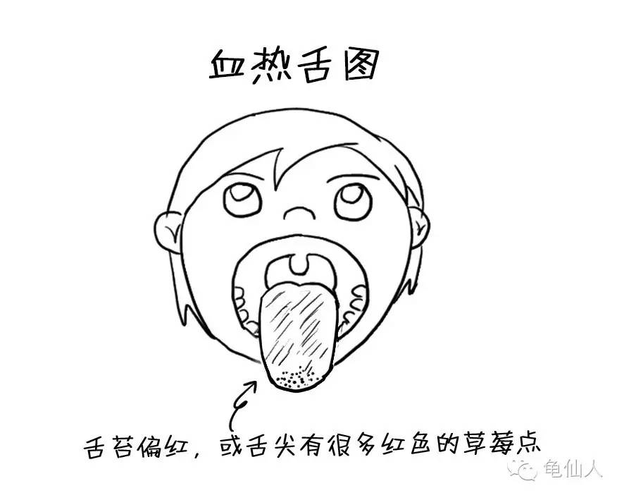 夏天湿疹难缠怎么办,如何对付湿疹