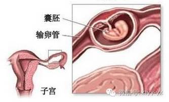 孕期出血有哪些危险,孕期阴道出血的症状
