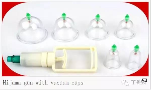 菲尔普斯自由泳100米拿过金牌吗,2008奥运会菲尔普斯拿了几个金牌