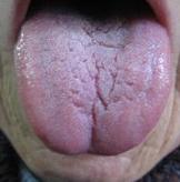 观察舌象的方法,一招教你看舌象图