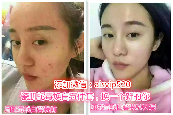 瓷肌美白怎么样效果好,瓷肌祛痘祛斑