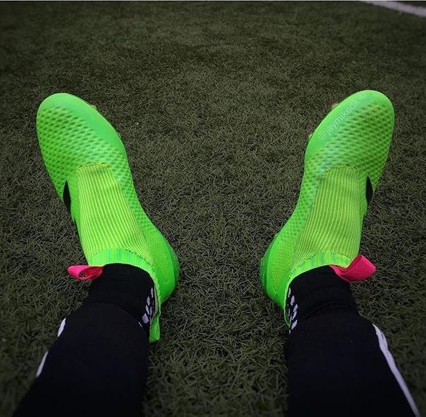 厄祖这双亮闪闪的鞋，用料竟然和手机壳一样