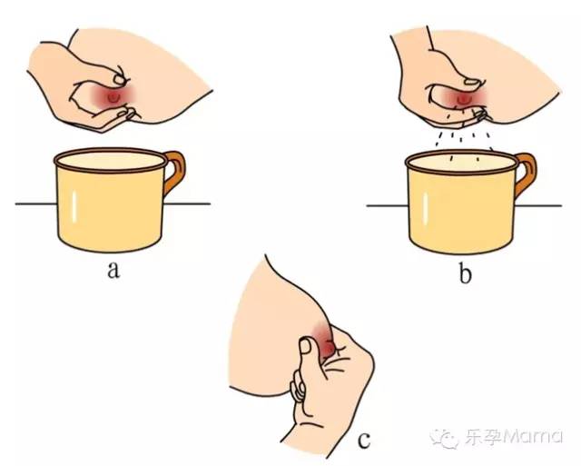 产后乳汁淤积原因及对策论文,乳汁淤积肿胀怎么办