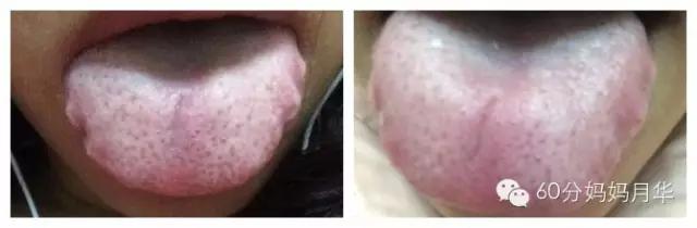 生完孩子后整天都感觉没力气怎么办？妈妈们需要多补血更关爱自己