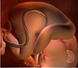 脐带长度异常原因,脐带异常是什么原因引起的