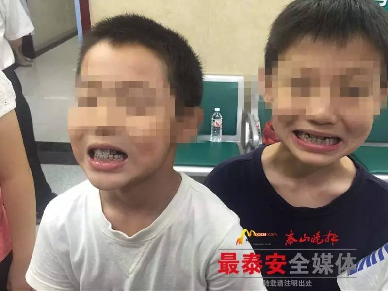 速看！*安泰**多名儿童在室内泳池游泳后舌苔、牙齿发黑...2人已确诊为霉菌感染！