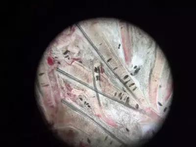 鱼类烂鳃病的防治方法,鱼鳃病怎么预防