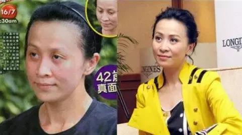 毛孔粗大怎么消除,毛孔粗大怎么消除最有效