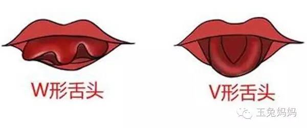 宝宝舌系带短吃不到奶可以剪吗,宝宝吃不到左边奶怎么回事