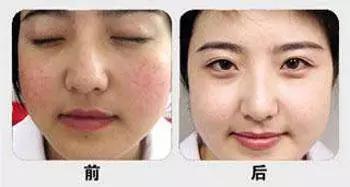 名医专访,专家医生谈敏感肌肤