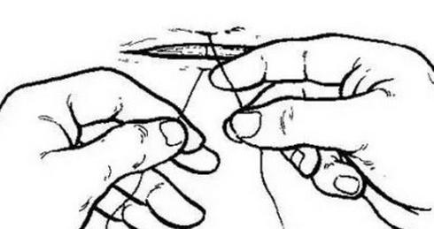 女性结扎恢复的手术过程,女性结扎的手术流程