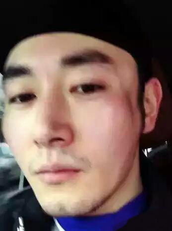 这个孙俪曾经“深爱”的男人，经历毁容却乐观积极！