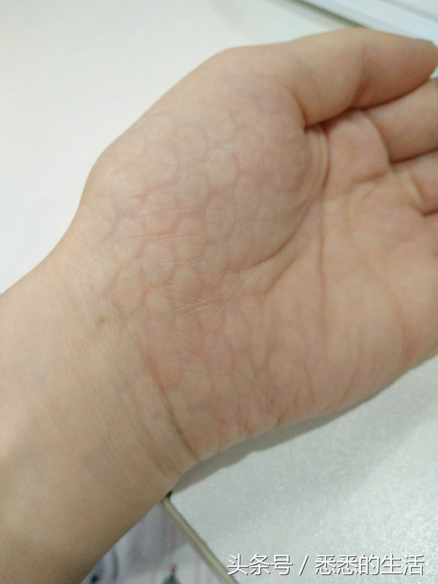 女孩身体长出鱼鳞,女孩醒来后发现自己长出鱼尾