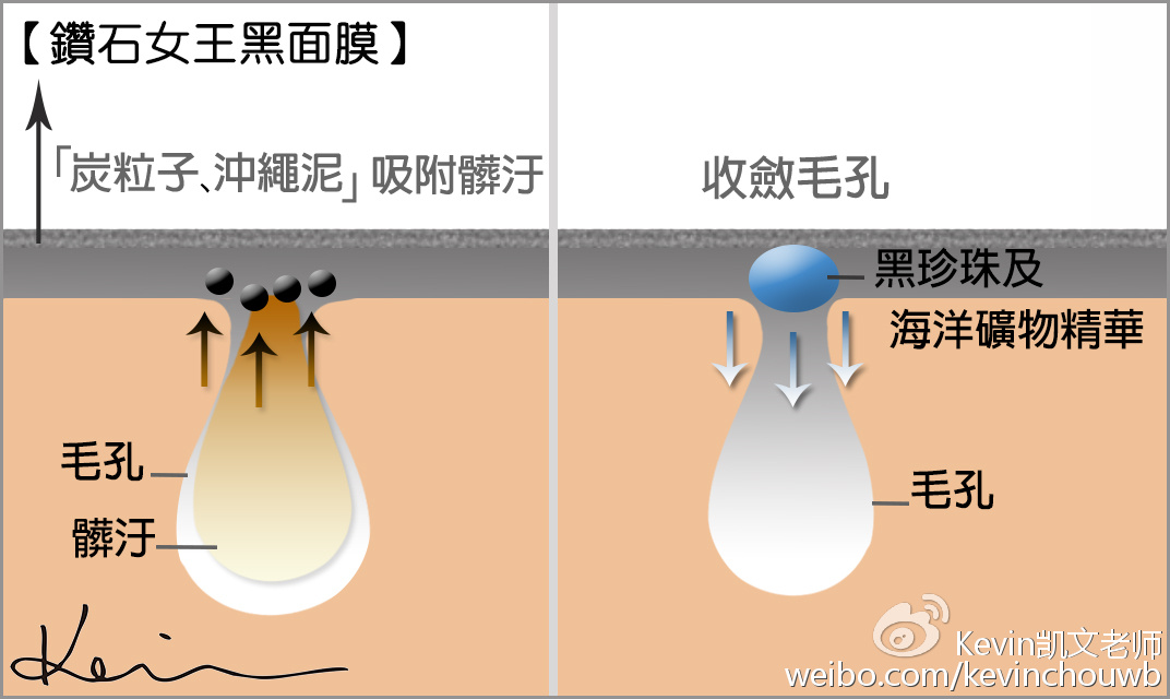 痘痘黑头粉刺用什么化妆品,痘痘粉刺黑头用什么化妆品