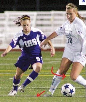 前交叉韧带1-2度损伤能自愈吗,前交叉韧带损伤一年还疼怎么回事