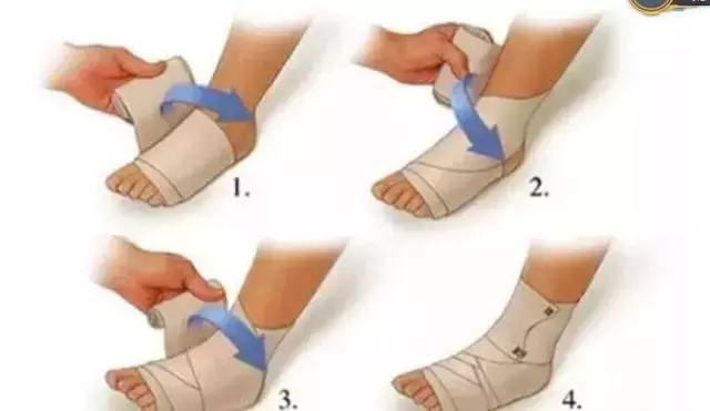 跑步扭伤脚踝,跑步扭伤了脚用什么药好