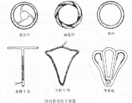 男人，如果你爱你的女人，就别让她上环！