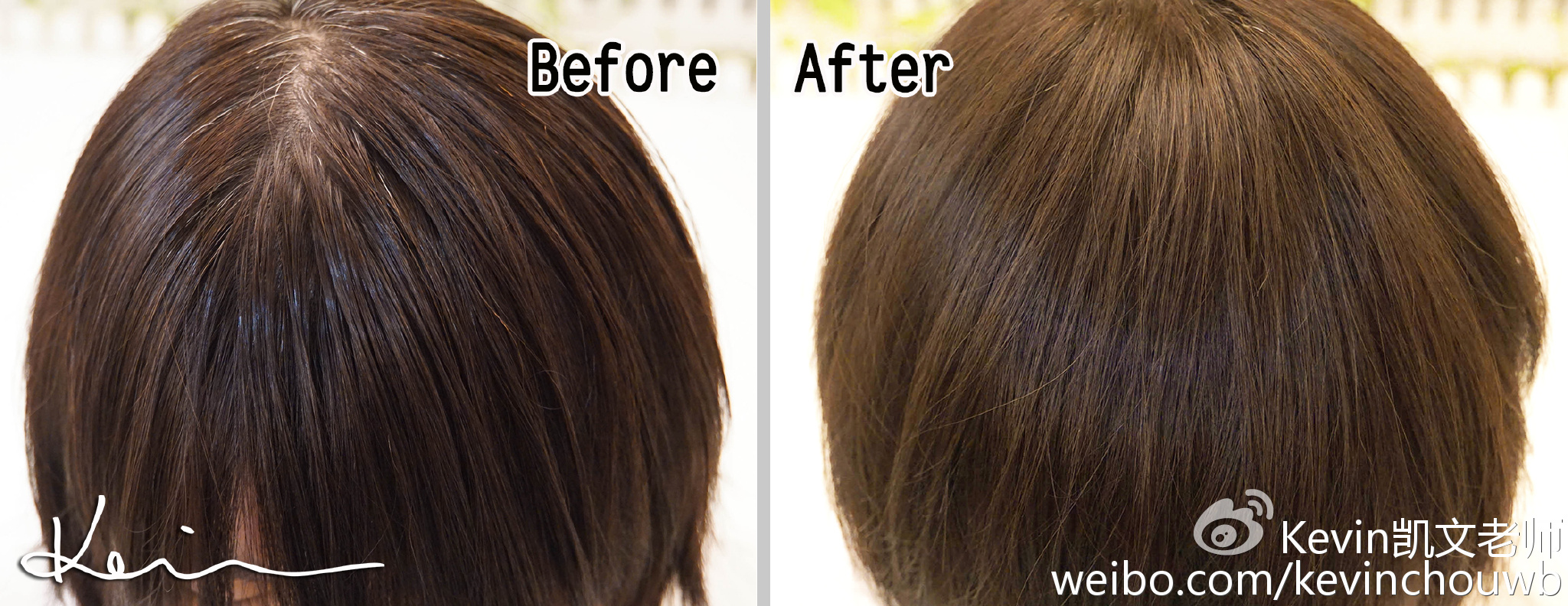 痘痘黑头粉刺用什么化妆品,痘痘粉刺黑头用什么化妆品