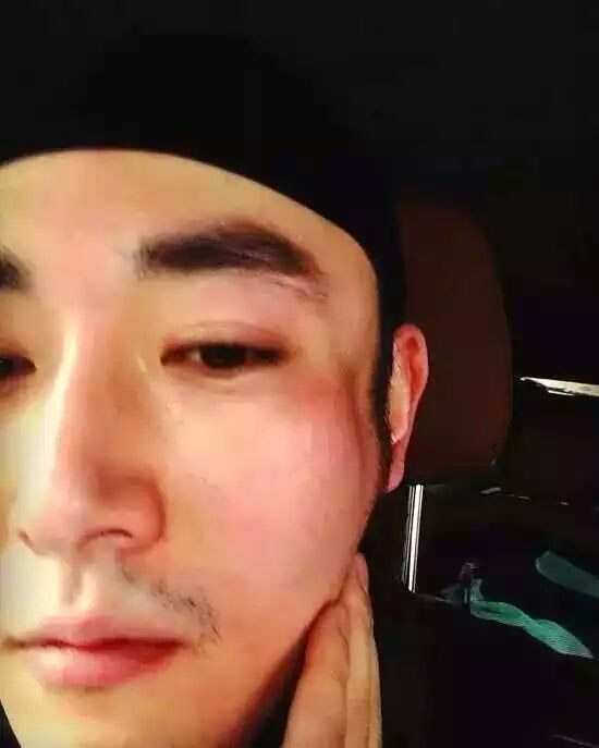 这个孙俪曾经“深爱”的男人，经历毁容却乐观积极！