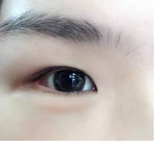 美瞳神器排行榜,美瞳神器单眼皮测评