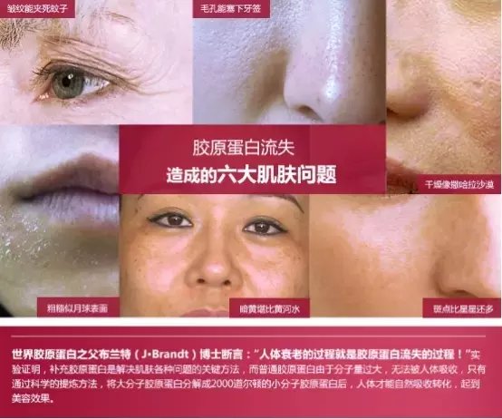 维昔老师分享，为什么那么多人都爱胶原蛋*粉白**呢？