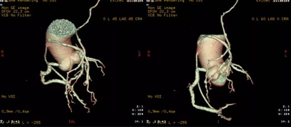 心力衰竭治疗要点的思维导图,心力衰竭疑难病例讨论记录模板