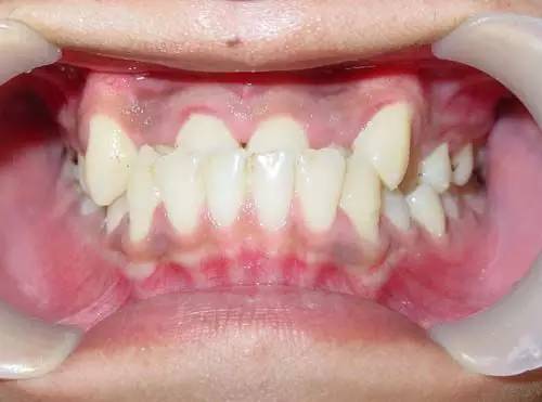 讲解换牙视频,换牙科普知识幼儿园