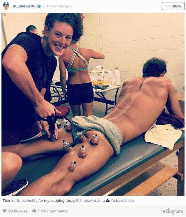 云健康丨一场奥运会，火了东方神秘的大中医