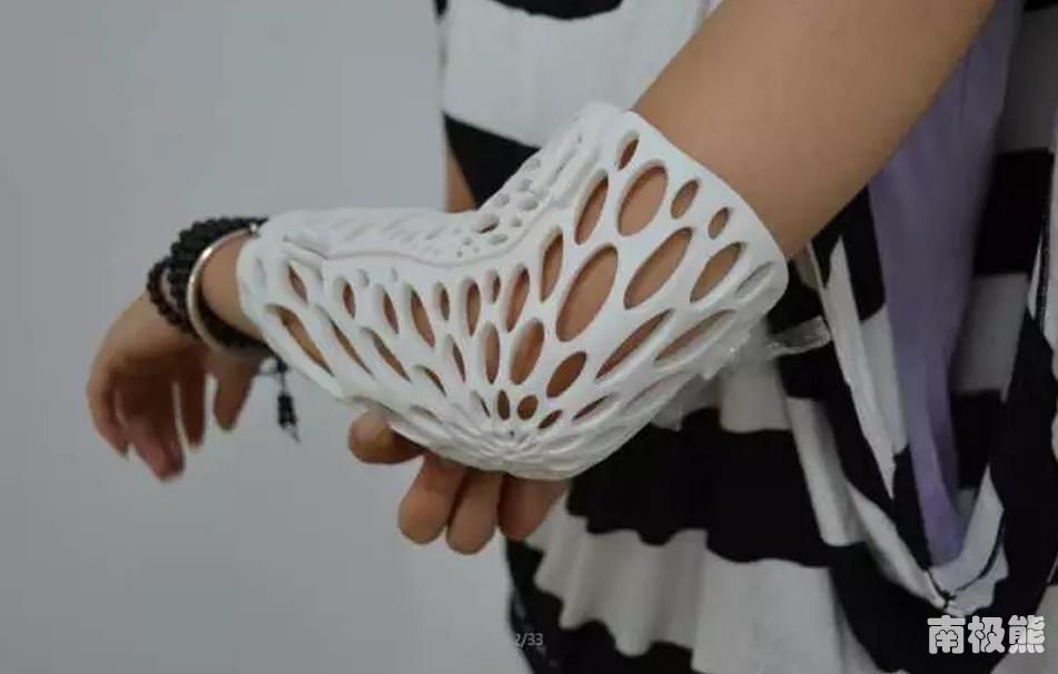 3d打印治骨折视频,3d打印治疗颌骨骨折