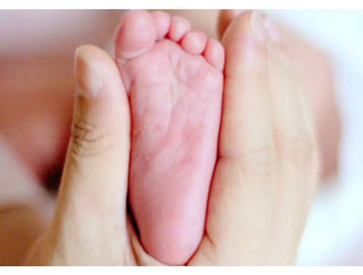 宝宝的脚长小水泡怎么回事,宝宝脚上面有水泡