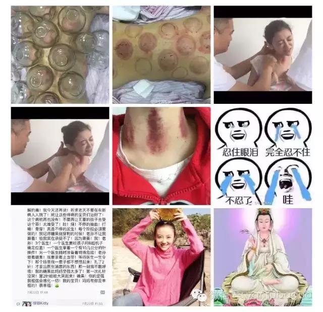 癌症去世的女艺人,患癌去世的年轻女艺人