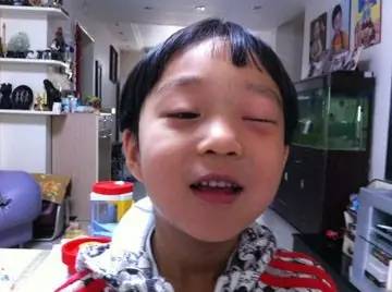 眼睛充血是红眼病么,红眼病会传染么