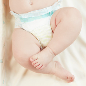 宝宝腿型不直先别急着去纠正，看看医生怎么说