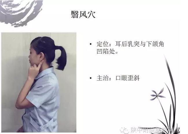 面神经炎的中医诊疗与中医护理