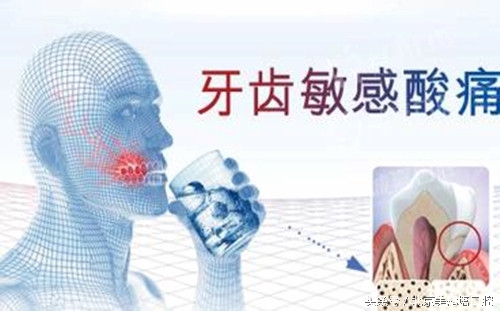 牙齿遇酸甜冷热就酸痛吃什么药,牙齿冷热酸甜不敢咬东西怎么办