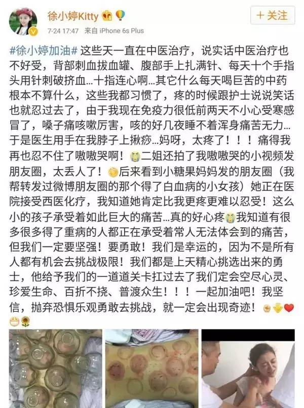 徐婷患淋巴癌,因淋巴癌故去的90后女艺人徐婷