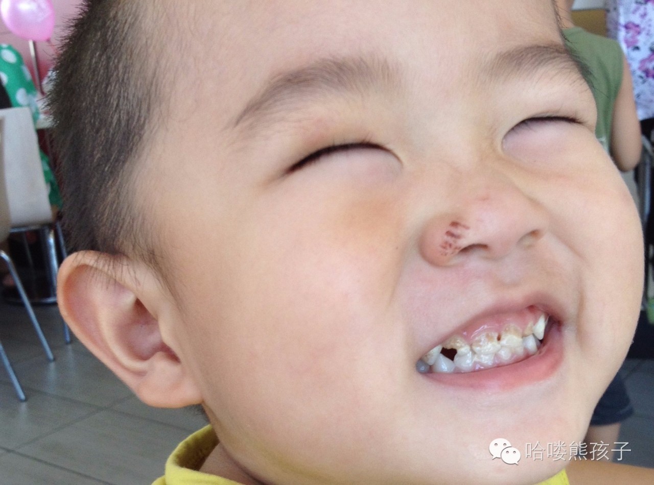 滚蛋吧拖延症,滚蛋吧幽门螺杆菌