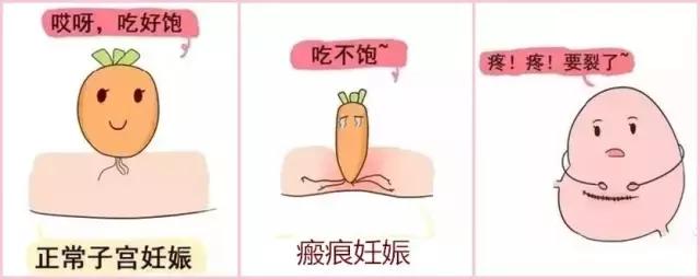 良辰吉时剖腹产,生孩子按吉时剖腹产