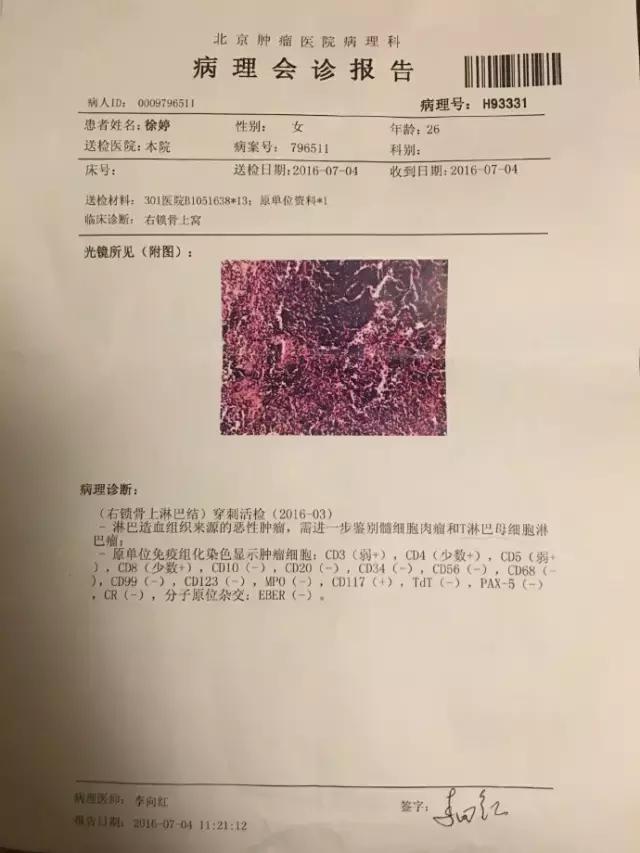 徐婷患淋巴癌,因淋巴癌故去的90后女艺人徐婷