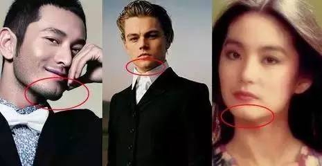 牙齿矫正跟颧骨有什么关系,牙齿矫正和凸嘴的区别