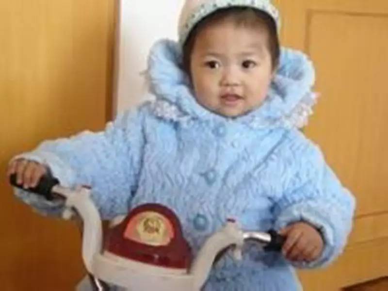 小孩青色胎记会自行消退吗,胎记哪种可以慢慢淡去