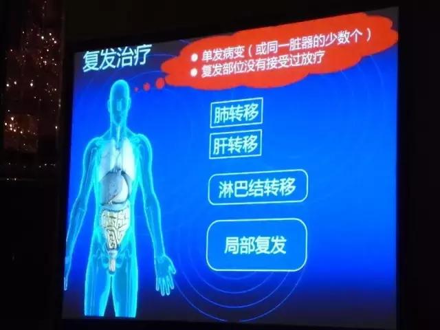 癌症复发转移还可以做质子治疗吗,质子治疗后复发可以用质子治疗吗