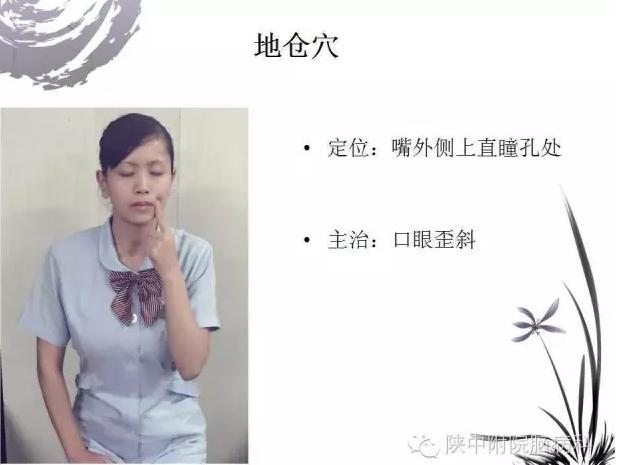 面神经炎的中医诊疗与中医护理