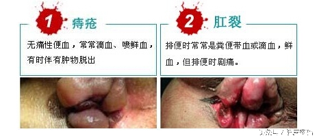 孕16周大出血一次不出了,孕妇怀孕六个月有点出血是怎么了