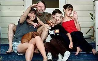 这个十四岁男孩，决定切掉自己的左脸