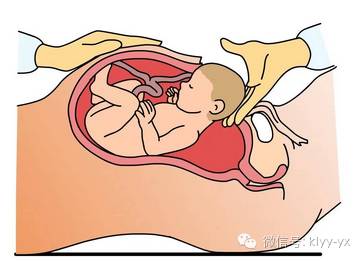 顺产胎儿是横位还是头位,分娩时胎头和骨盆关系