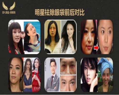 田七美肌钥匙袋袋霜