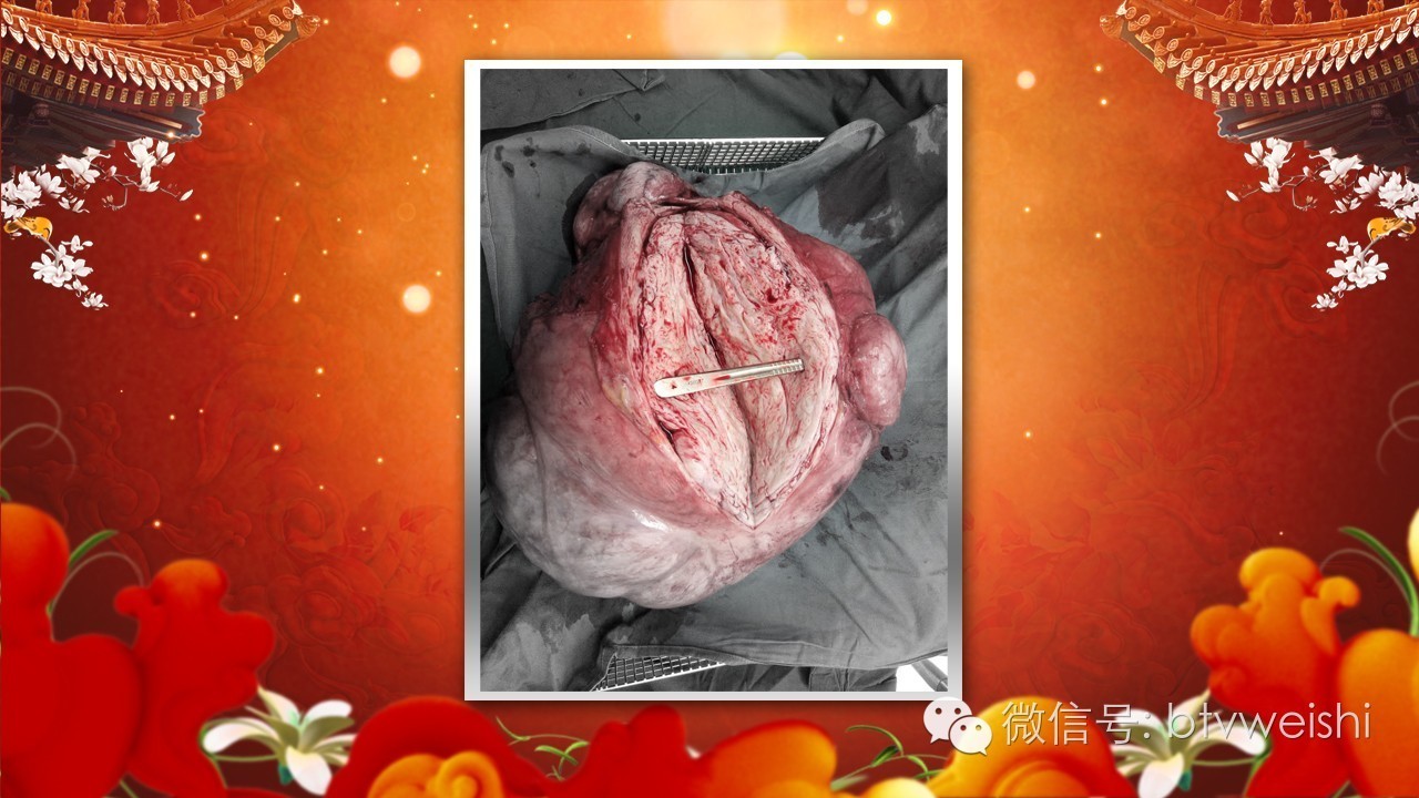 养生堂癌症,养生堂今日播出视频